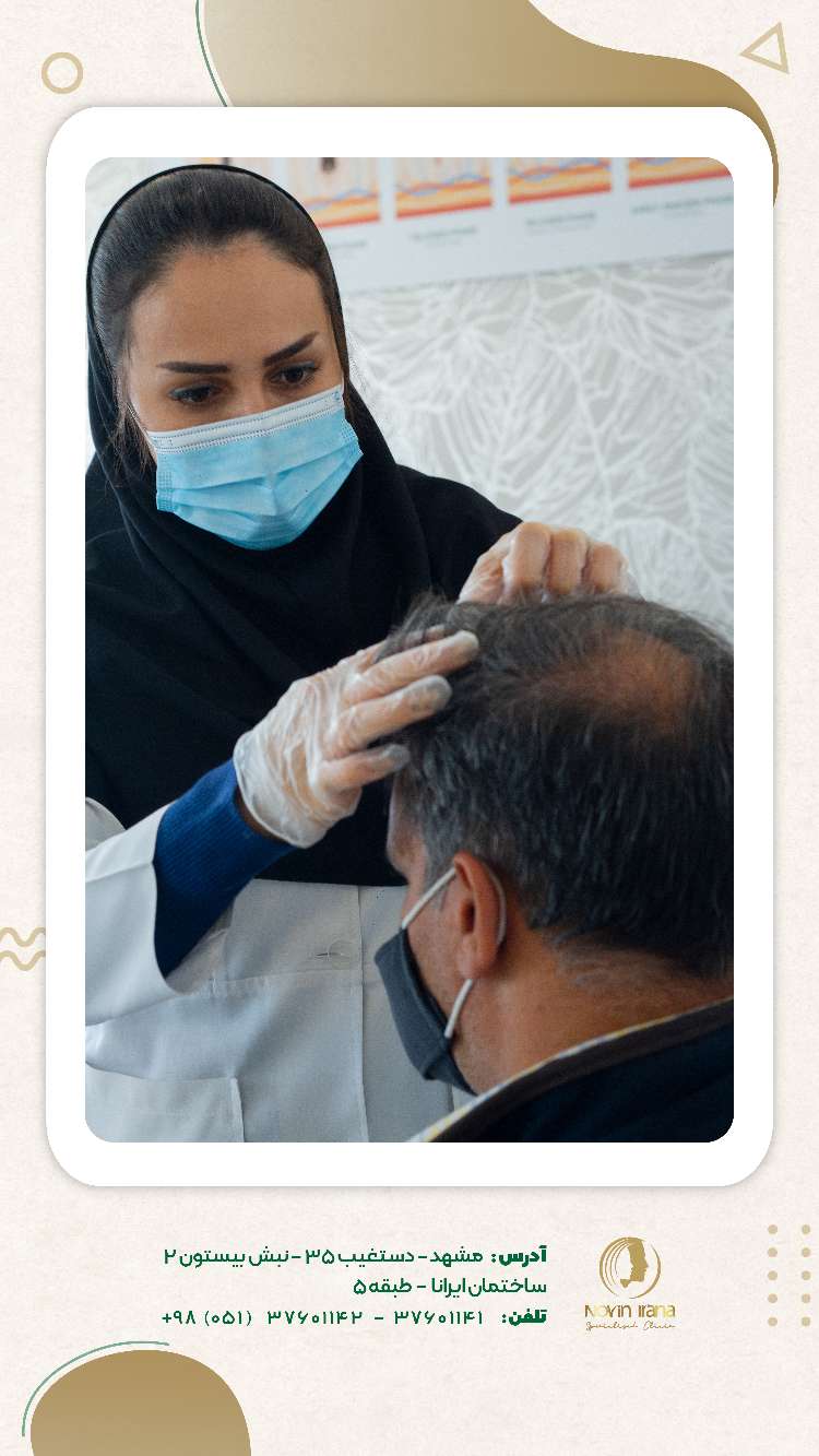 نمونه کاشت مو