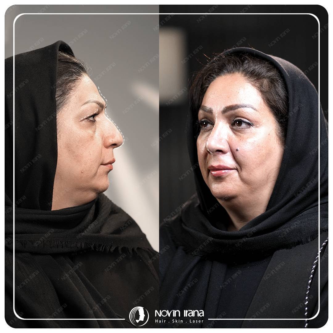 عنوان Farsi
