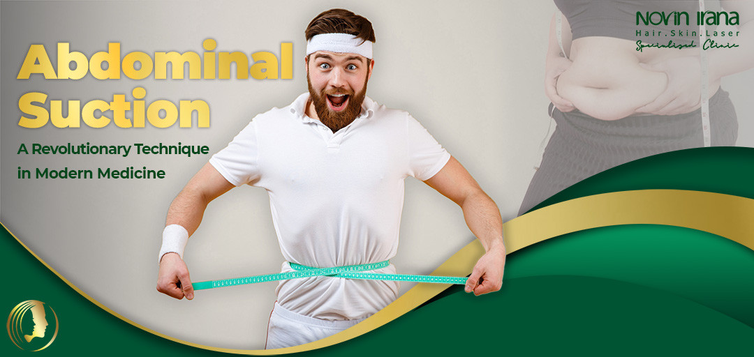 abdominal suction