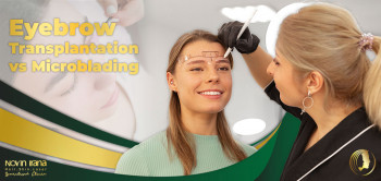 Eyebrow Transplantation vs Microblading
