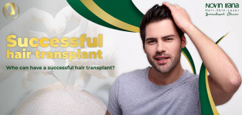Who can have a successful hair transplant