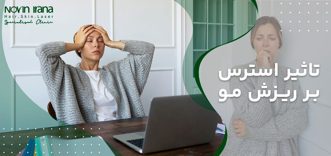 تاثیر استرس بر ریزش مو