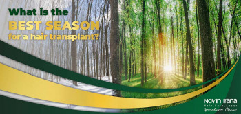 the best season for a hair transplant