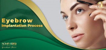 Eyebrow Implantation