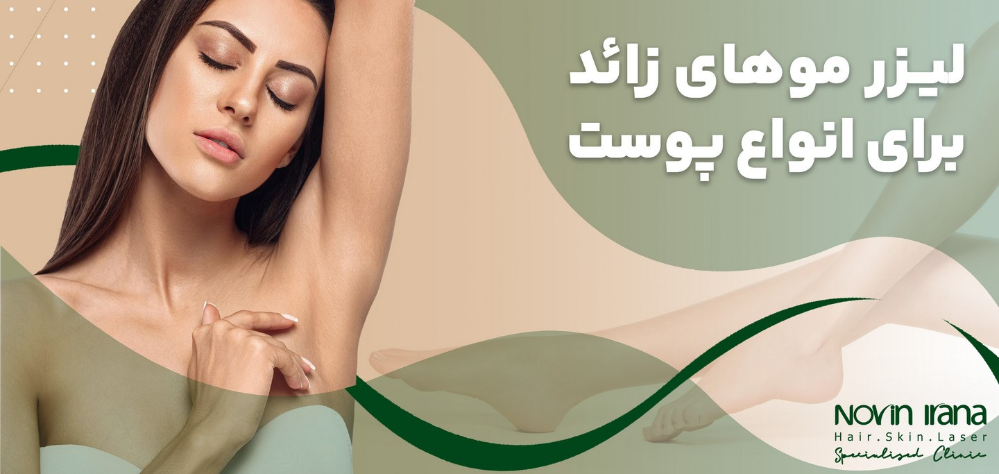 لیزر موهای زائد برای انواع مختلف پوست
