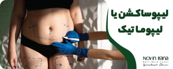 لیپوساکشن یا لیپوماتیک