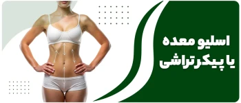 اسلیو معده یا پیکرتراشی