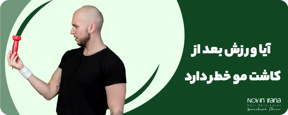 ورزش بعد از کاشت مو