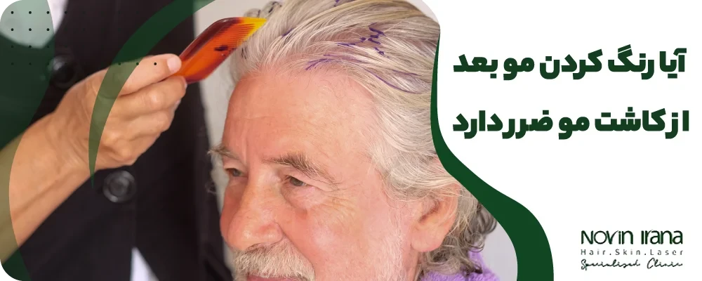 رنگ کردن مو بعد از کاشت مو
