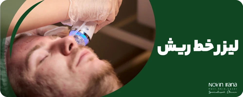 لیزر خط ریش