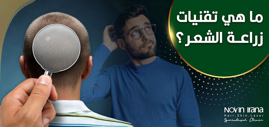 ما هي تقنيات زراعة الشعر