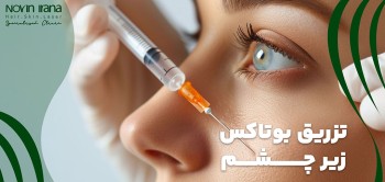 تزریق بوتاکس زیر چشم