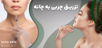 تزریق چربی به چانه
