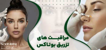 مراقبت های تزریق بوتاکس