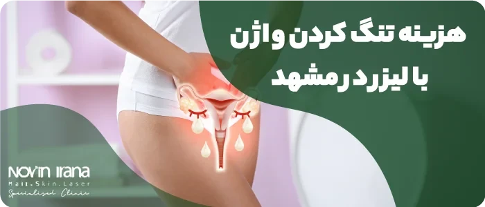هزینه تنگ كردن واژن با لیزر در مشهد