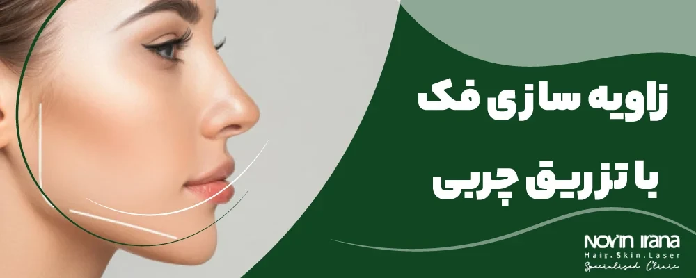 زاویه‌سازی فک با تزریق چربی