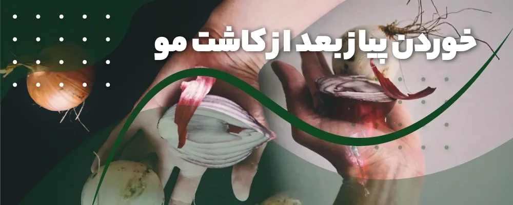 خوردن پیاز بعد از کاشت مو