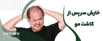 خارش سر بعد از کاشت مو