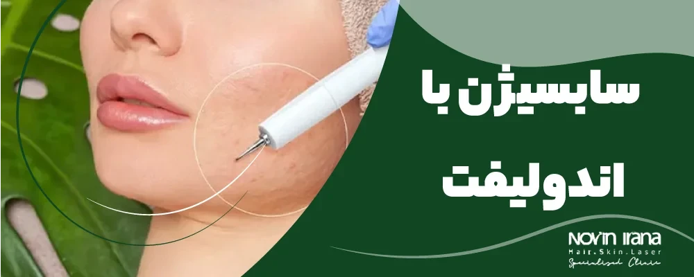 سابسیژن با اندولیفت