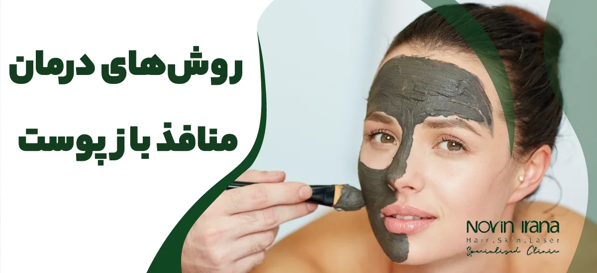 درمان منافذ باز پوست