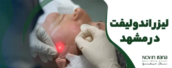 لیزر اندولیفت در مشهد