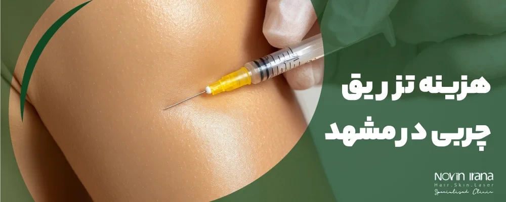 هزینه تزریق چربی در مشهد