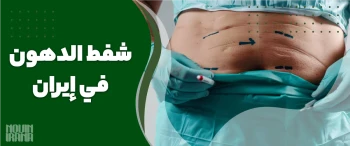 شفط الدهون في إيران