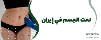 نحت الجسم في إيران
