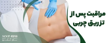 مراقبت پس از تزریق چربی