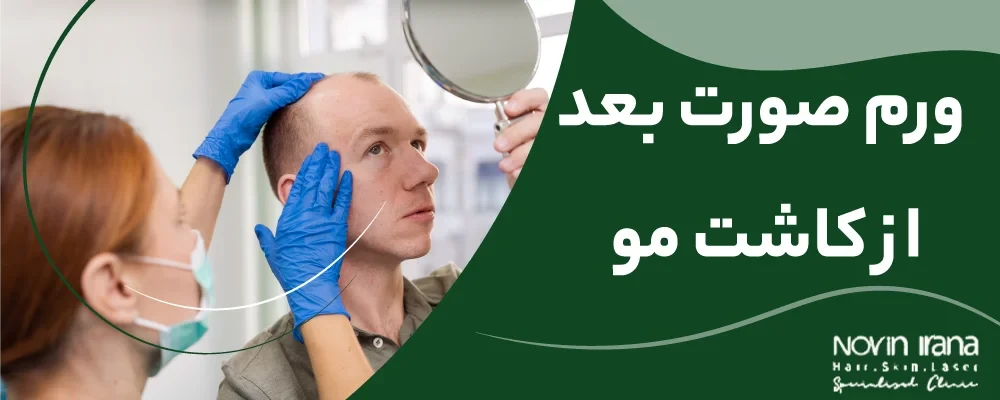 ورم صورت بعد از کاشت مو