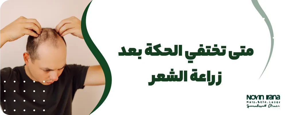متى تختفي الحكة بعد زراعة الشعر