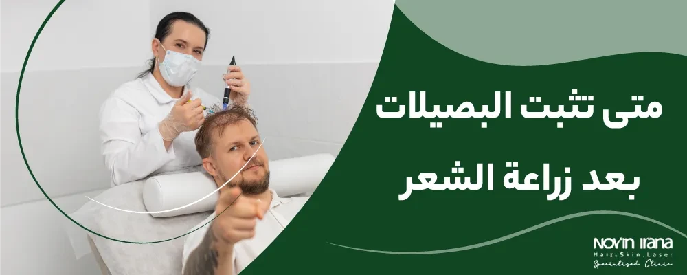 متى تثبت البصيلات بعد زراعة الشعر