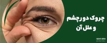 چروک دور چشم