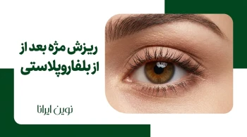 ریزش مژه بعد از بلفاروپلاستی