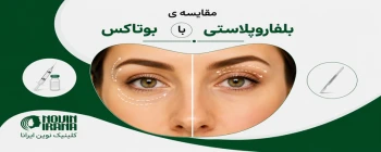 مقایسه ی بلفاروپلاستی با بوتاکس