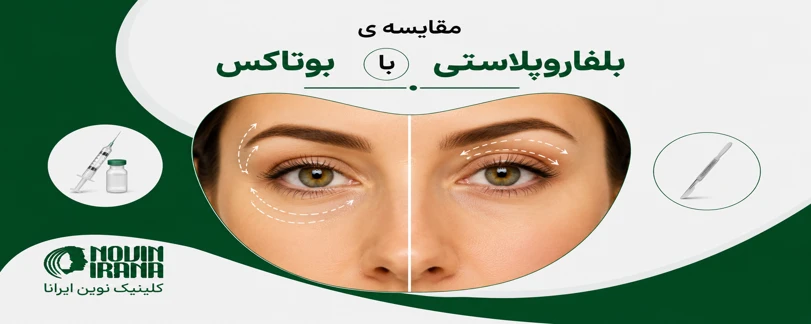 مقایسه ی بلفاروپلاستی با بوتاکس
