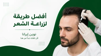 أفضل طريقة لزراعة الشعر