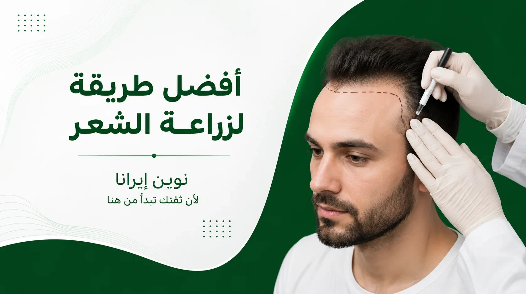 أفضل طريقة لزراعة الشعر