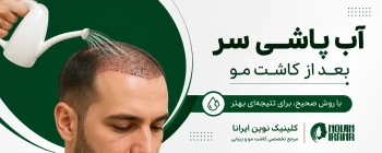 آب پاشی سر بعد از کاشت مو
