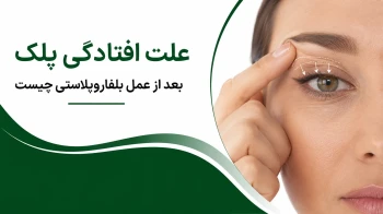 علت افتادگی پلک بعد از عمل بلفاروپلاستی