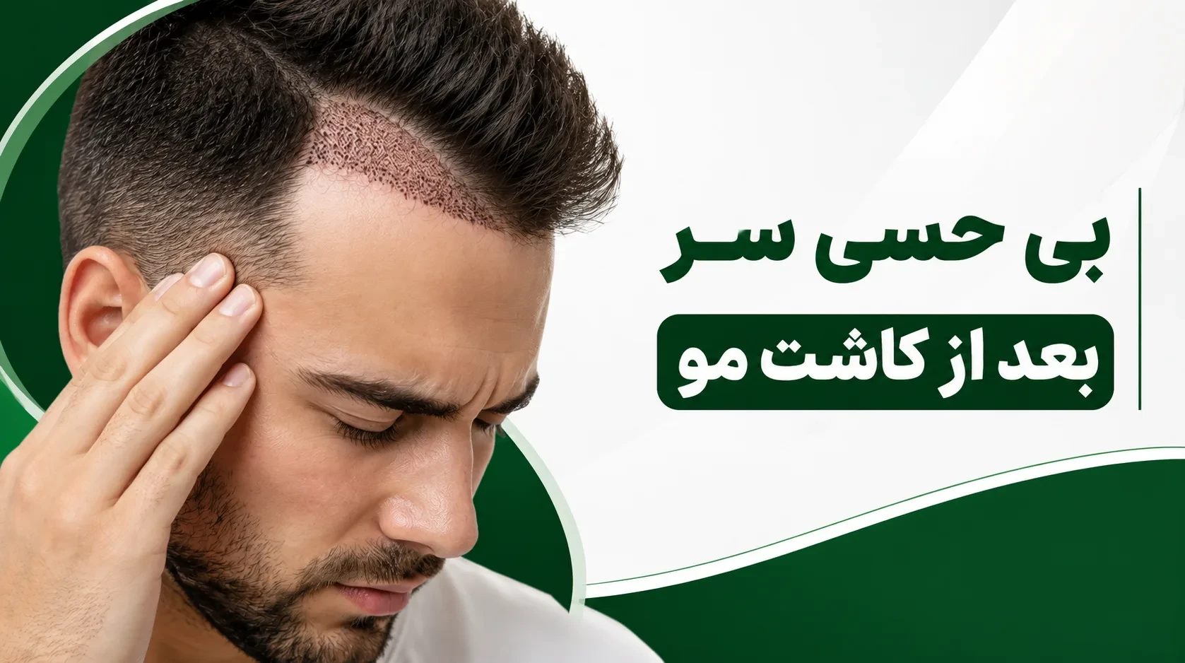بی حسی سر بعد از کاشت مو