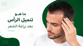 تنميل الرأس بعد زراعة الشعر