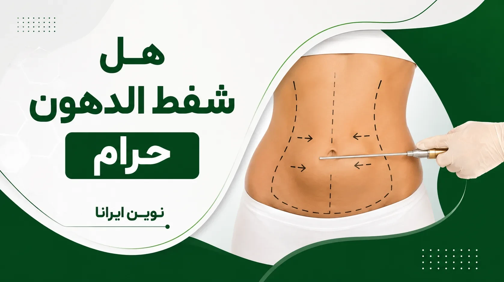 هل شفط الدهون حرام