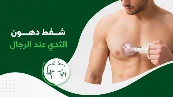 شفط دهون الثدي عند الرجال