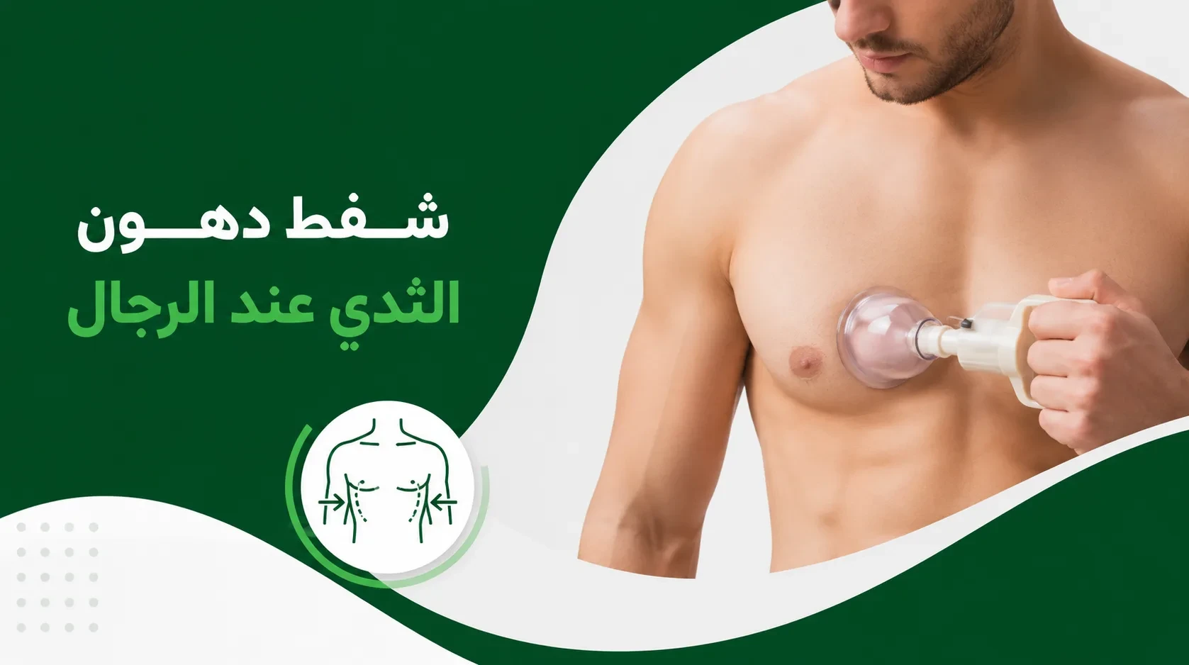 شفط دهون الثدي عند الرجال