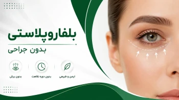 بلفاروپلاستی بدون جراحی