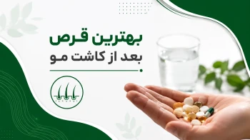 بهترین قرص بعد از کاشت مو