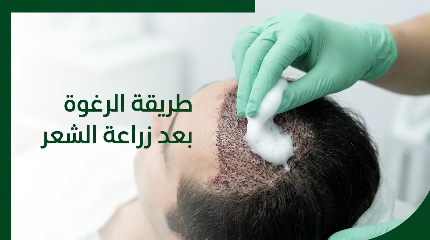 طريقة الرغوة بعد زراعة الشعر