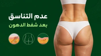 عدم التناسق بعد شفط الدهون