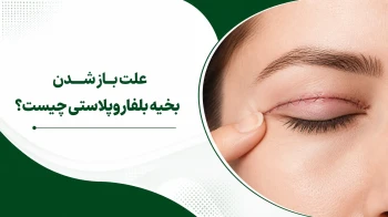 باز شدن بخیه بلفاروپلاستی